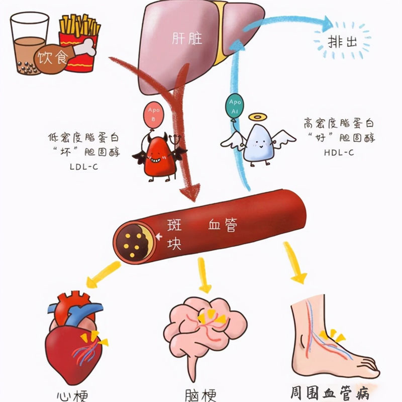 血脂四項的重要性.jpg